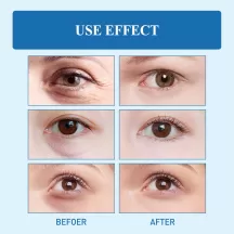 West&Month Snake Venom Peptide Repair Eye Cream