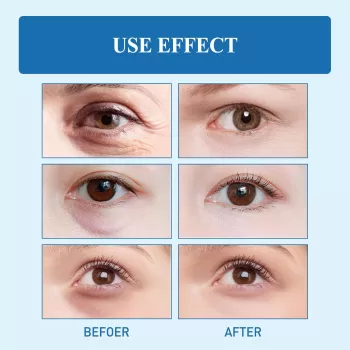 West&Month Snake Venom Peptide Repair Eye Cream West&Month Snake Venom Peptide Repair Eye Cream
