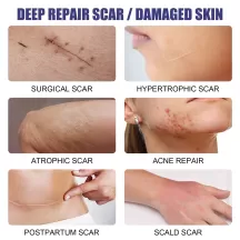 West&Month Lavender Scar Repair Serum
