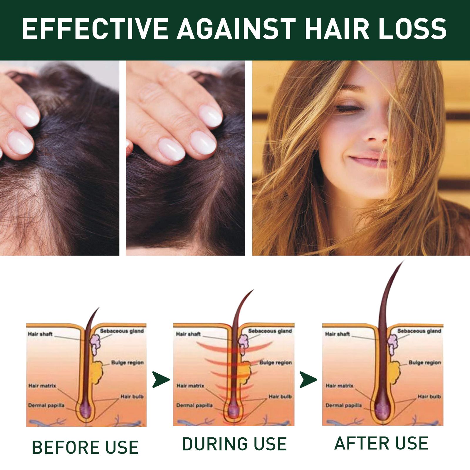 West Month Ginger Hair Growth Shampoo 1