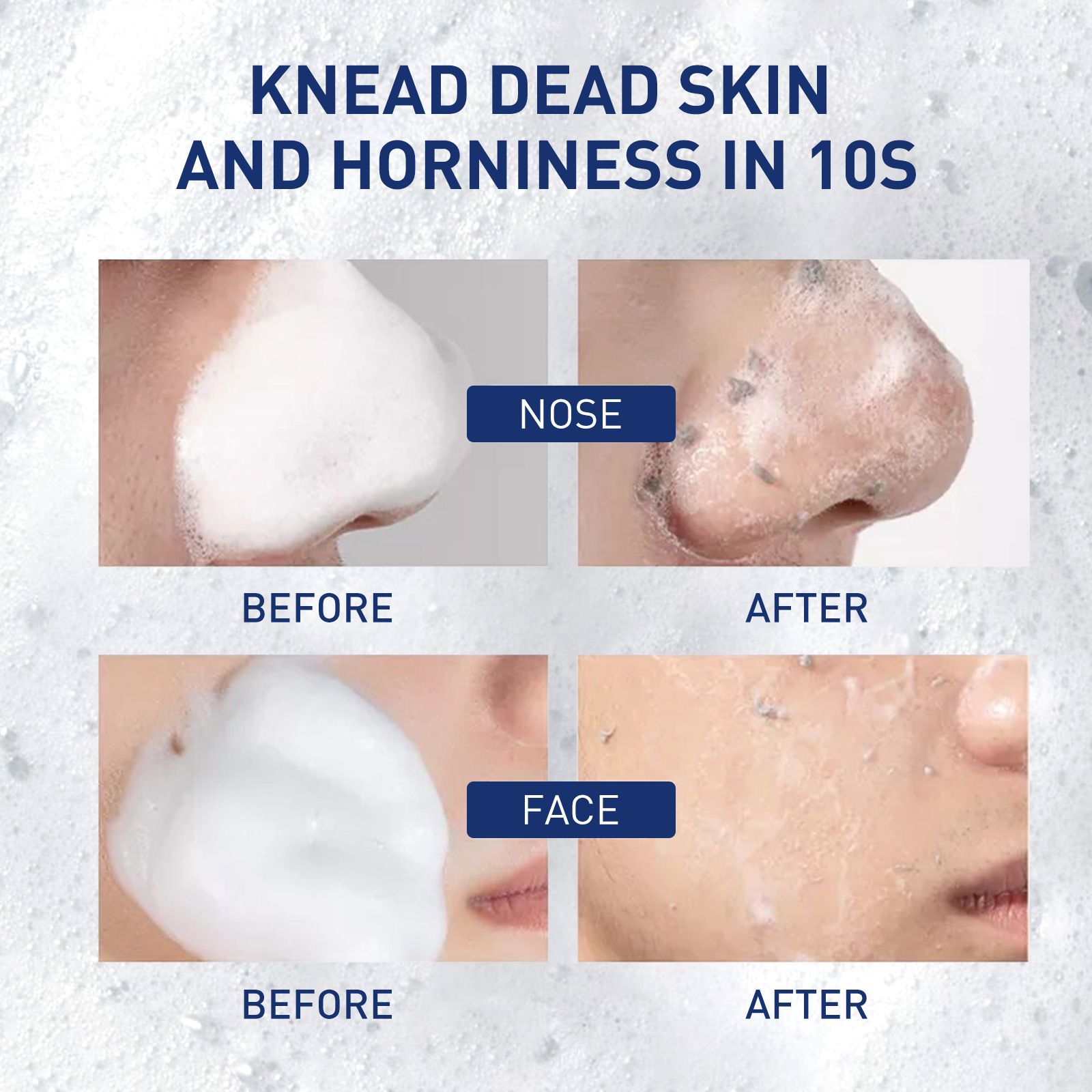 West Month Facial Exfoliating Form Mousse 3