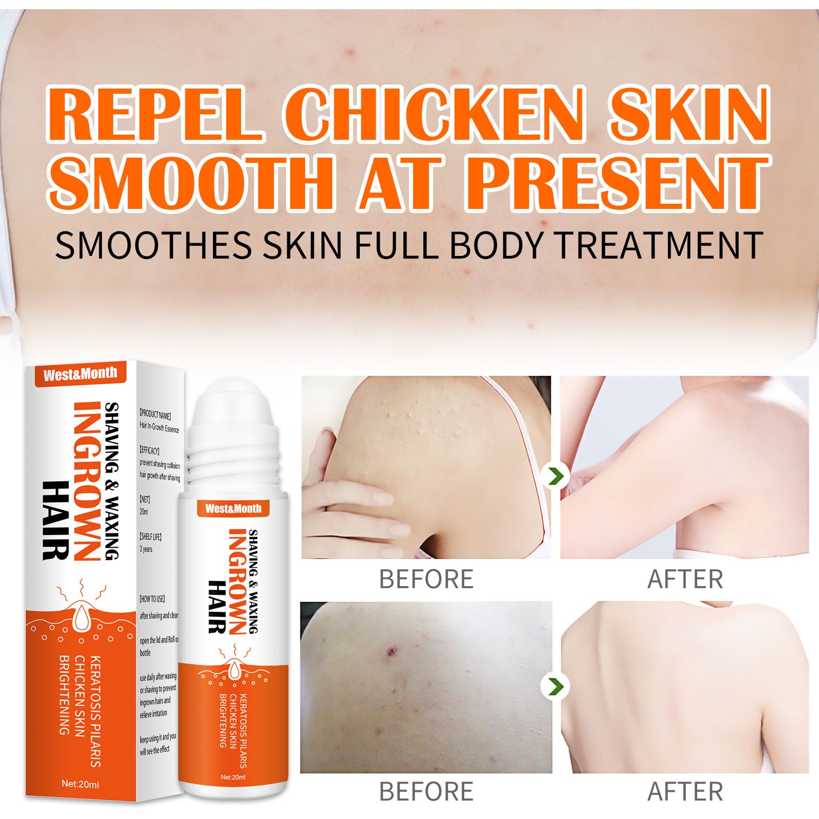 West&Month Ingrown Hairs Treatment Oil 2