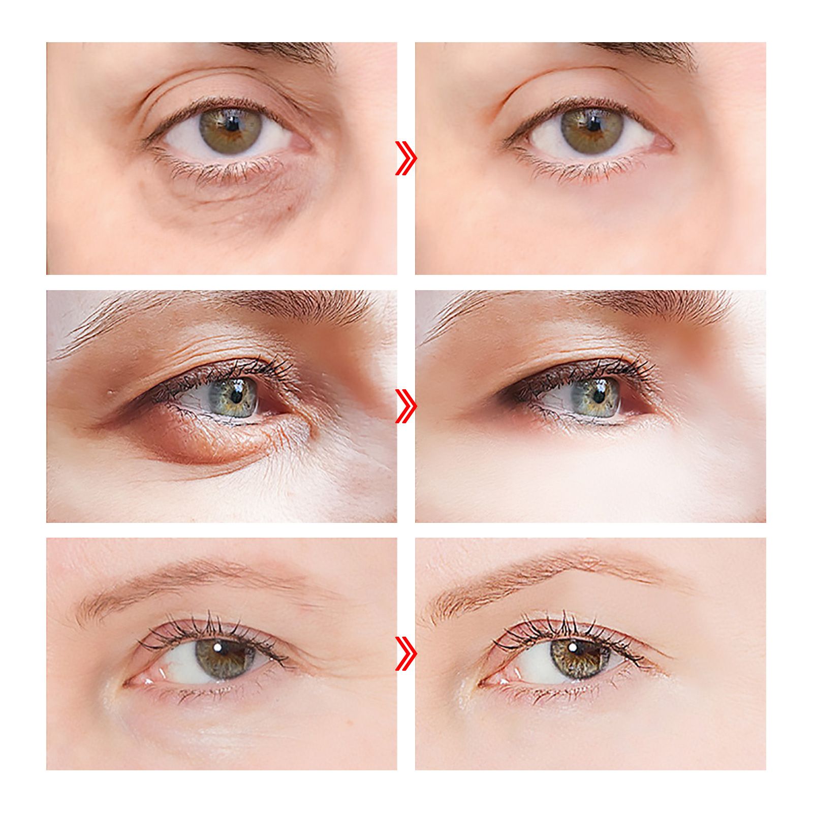 West&Month Pro-Xylane Active Anti-Wrinkle Eye Serum 2