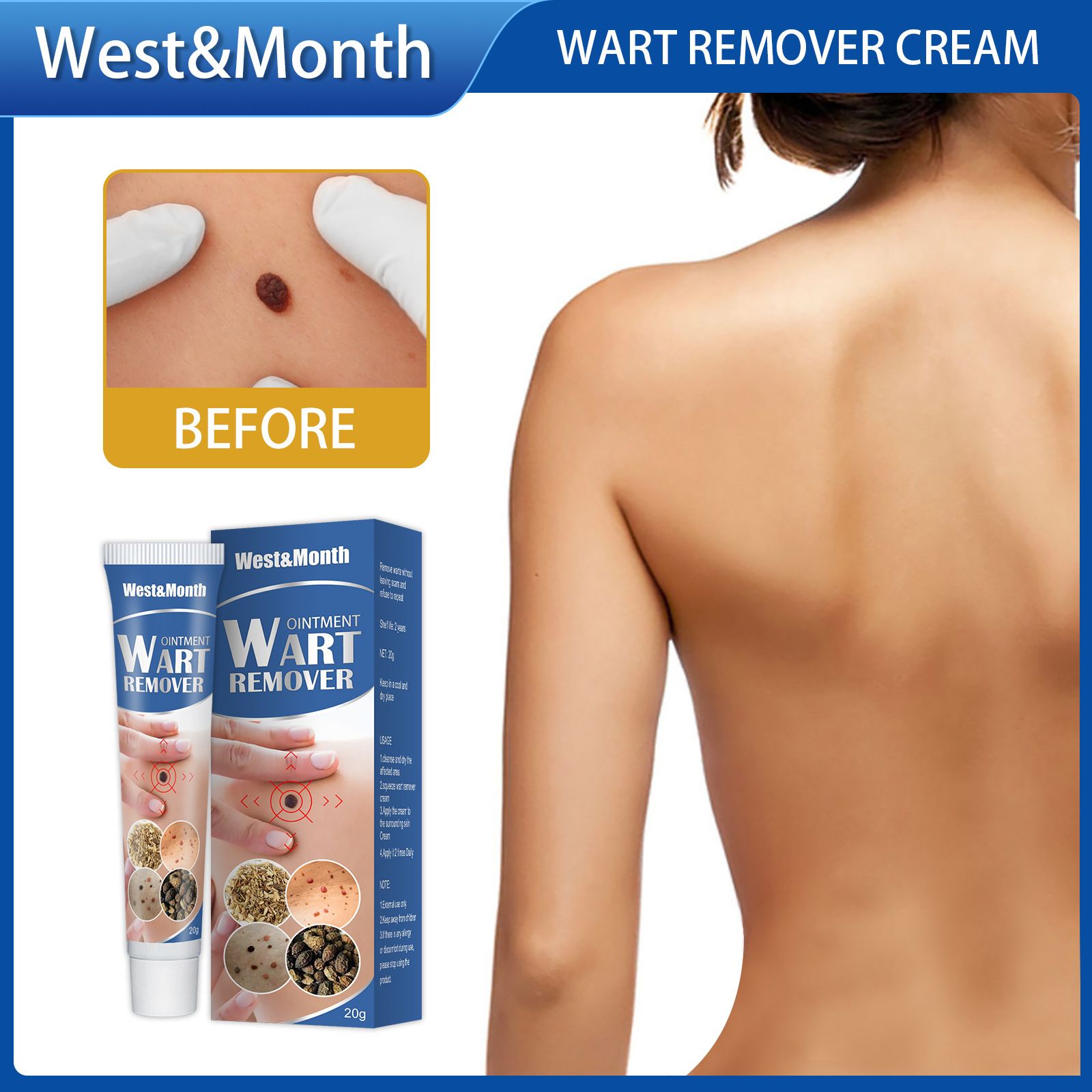 West&Month Wart Remover Skin Tags Removal Ointment
