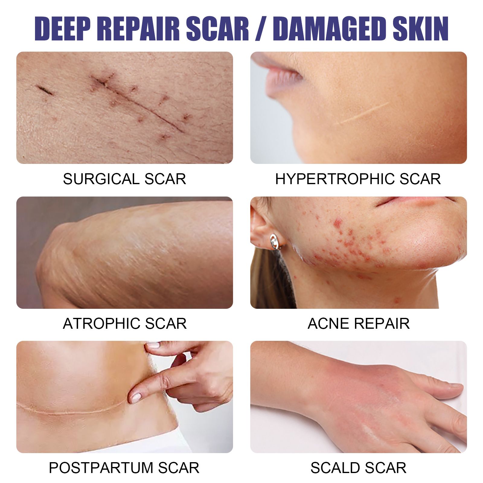 West&Month Lavender Scar Repair Serum 2