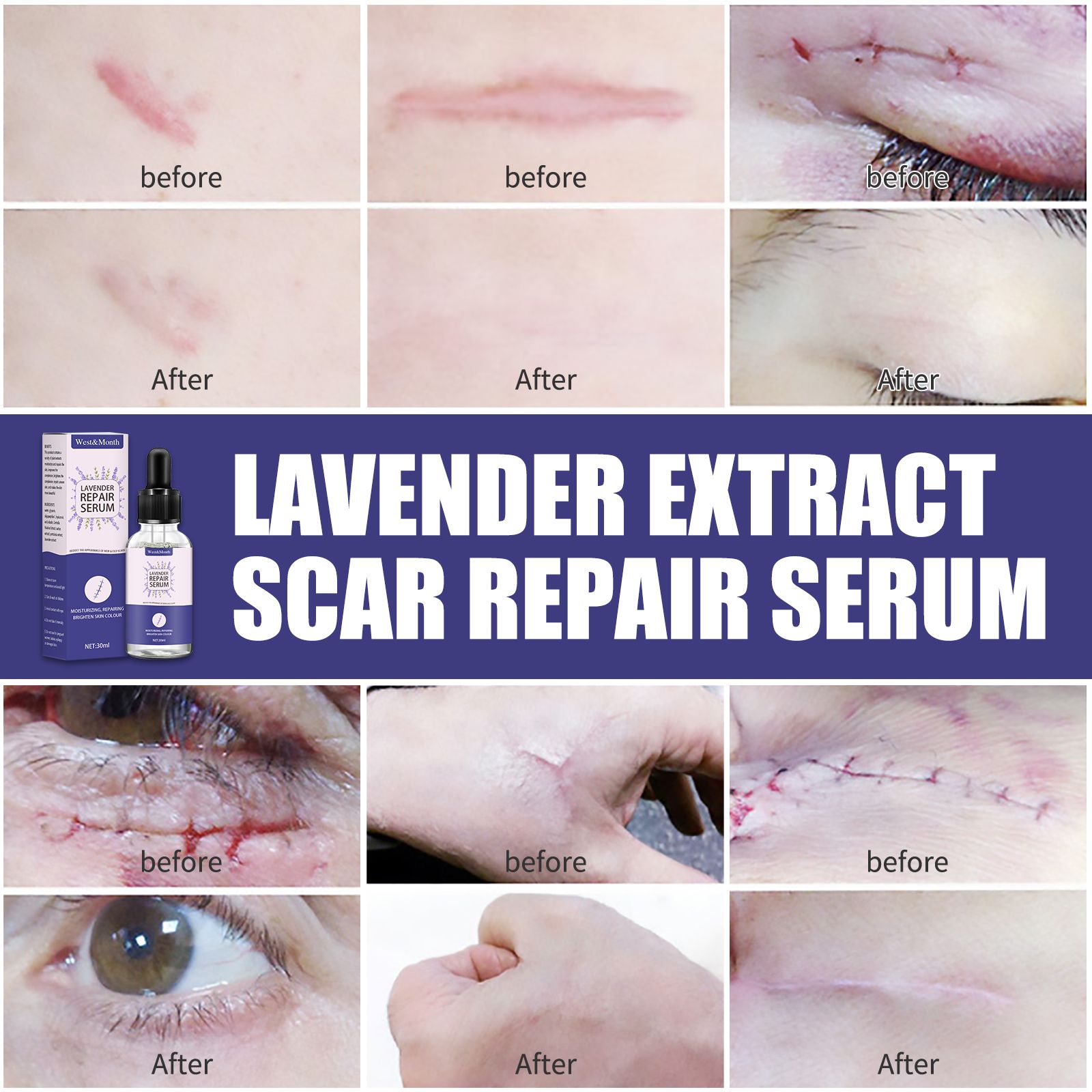 West&Month Lavender Scar Repair Serum 3